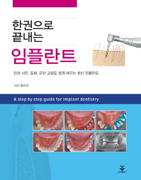 (한권으로 끝내는) 임플란트 = A step by step guide for implant dentistry : 임상 사진, 도해, 문헌 고찰로 쉽게 배우는 최신 임플란트 책표지