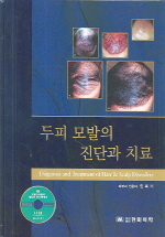 두피 모발의 진단과 치료 = Diagnosis and treatment of hair & scalp disorders 책표지