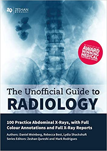 (The) unofficial guide to radiology : 100 practice chest x-rays, with full colour annotations and full x-ray reports 책표지
