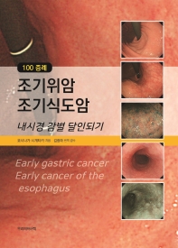 100 증례 조기위암·조기식도암 내시경 감별 달인되기 책표지