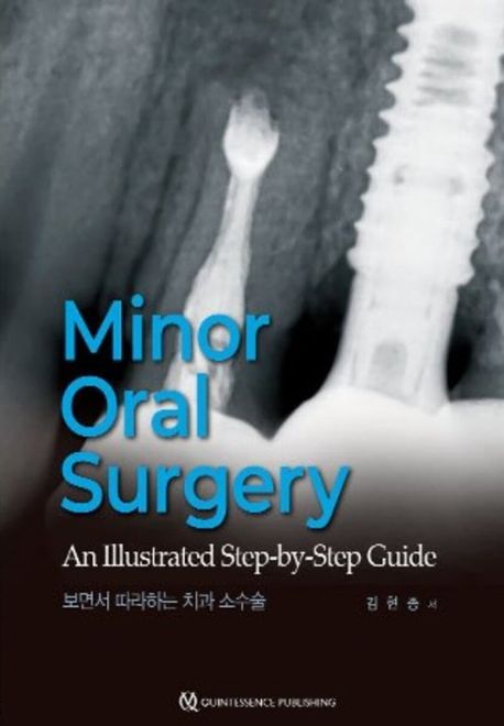 Minor oral surgery : an illustrated step-by step guide  보면서 따라하는 치과 소수술 책표지
